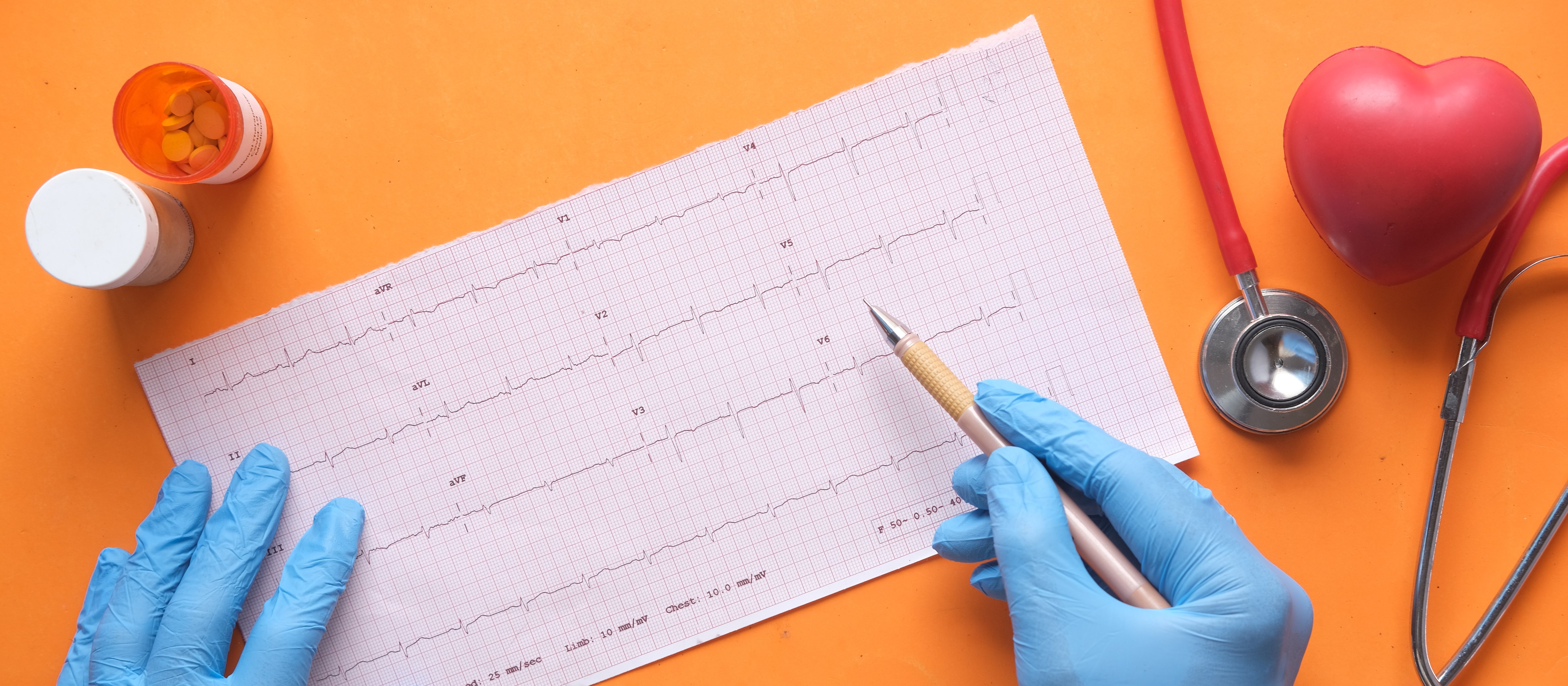 Image shows gloved hands checking an ECG report, with stethoscope and heart image on an orange background