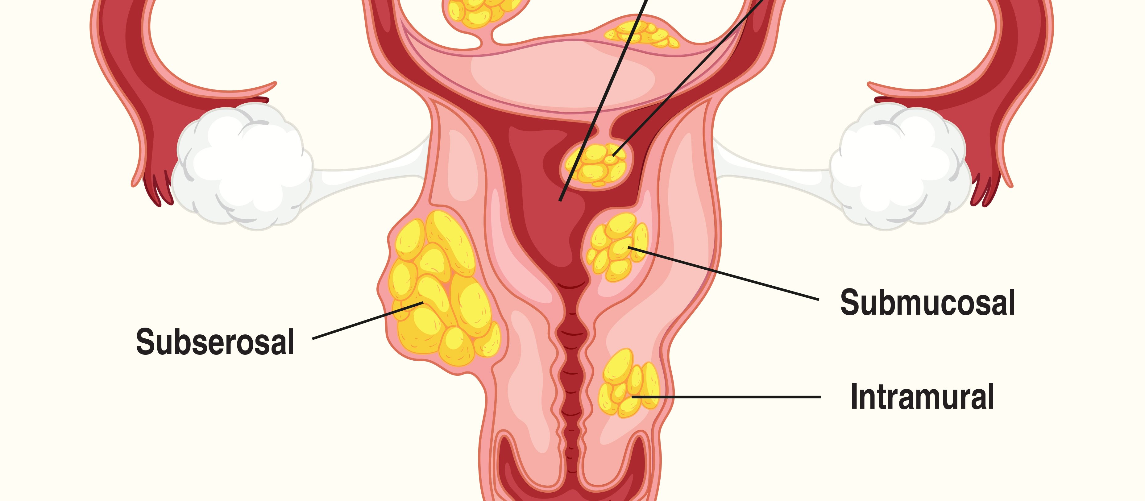 Uterus