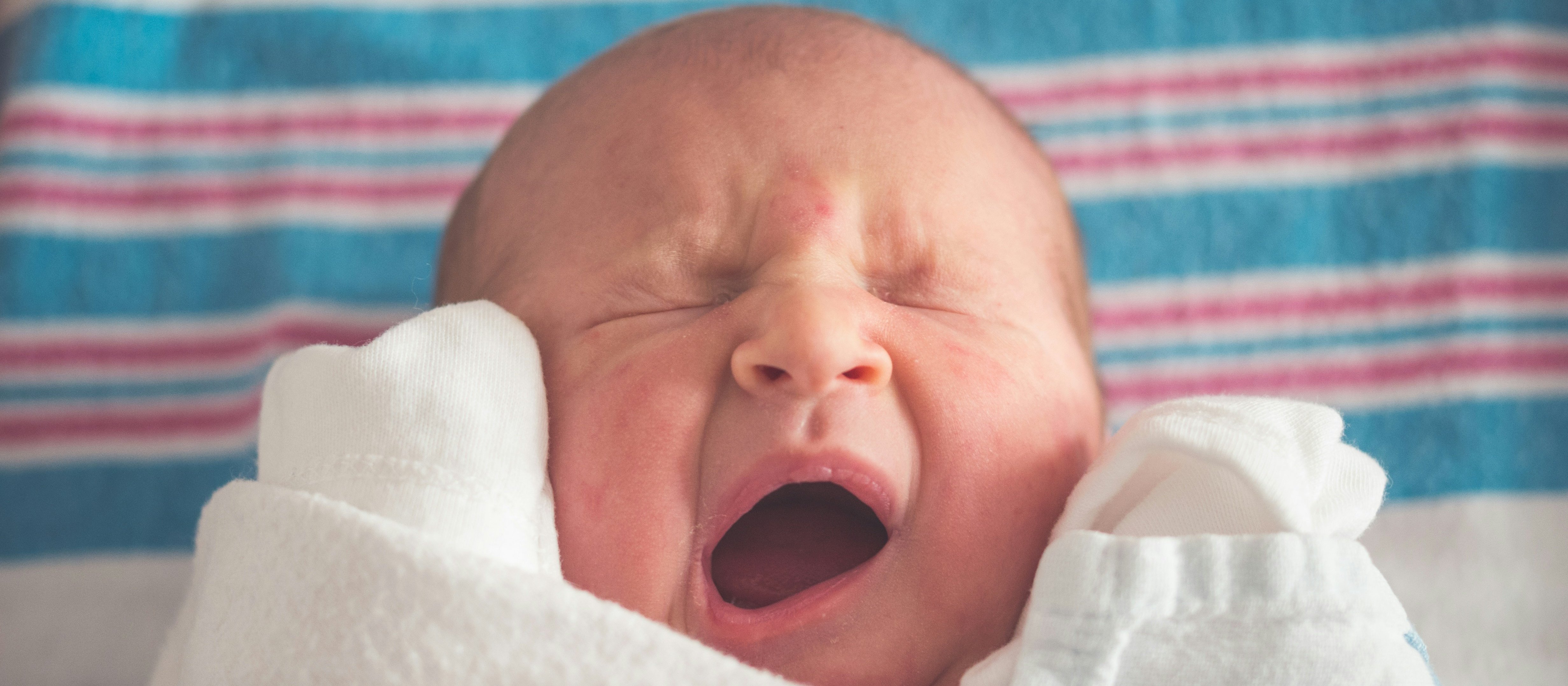 A newborn yawns, they're swaddled in white and lying on a white blanket with blue and pink stripes