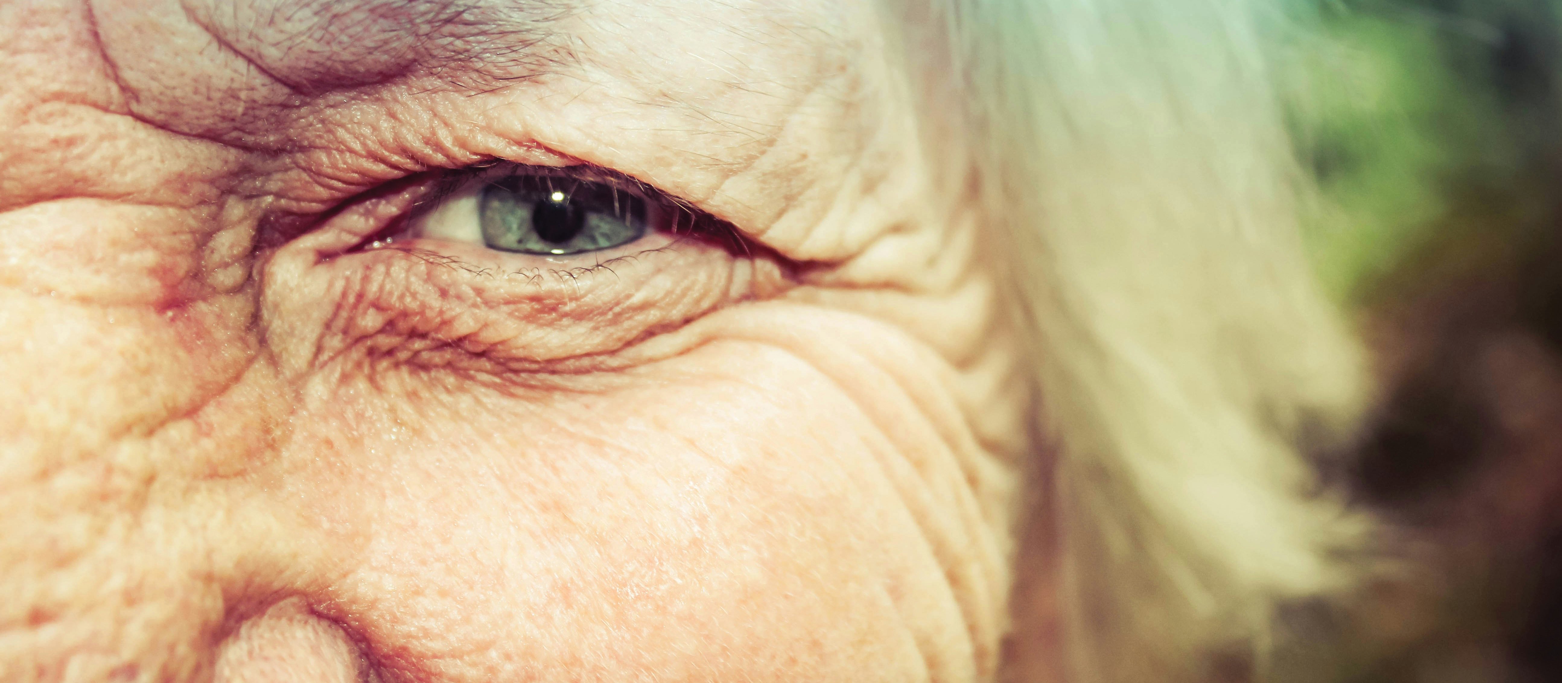 Elderly lady eye