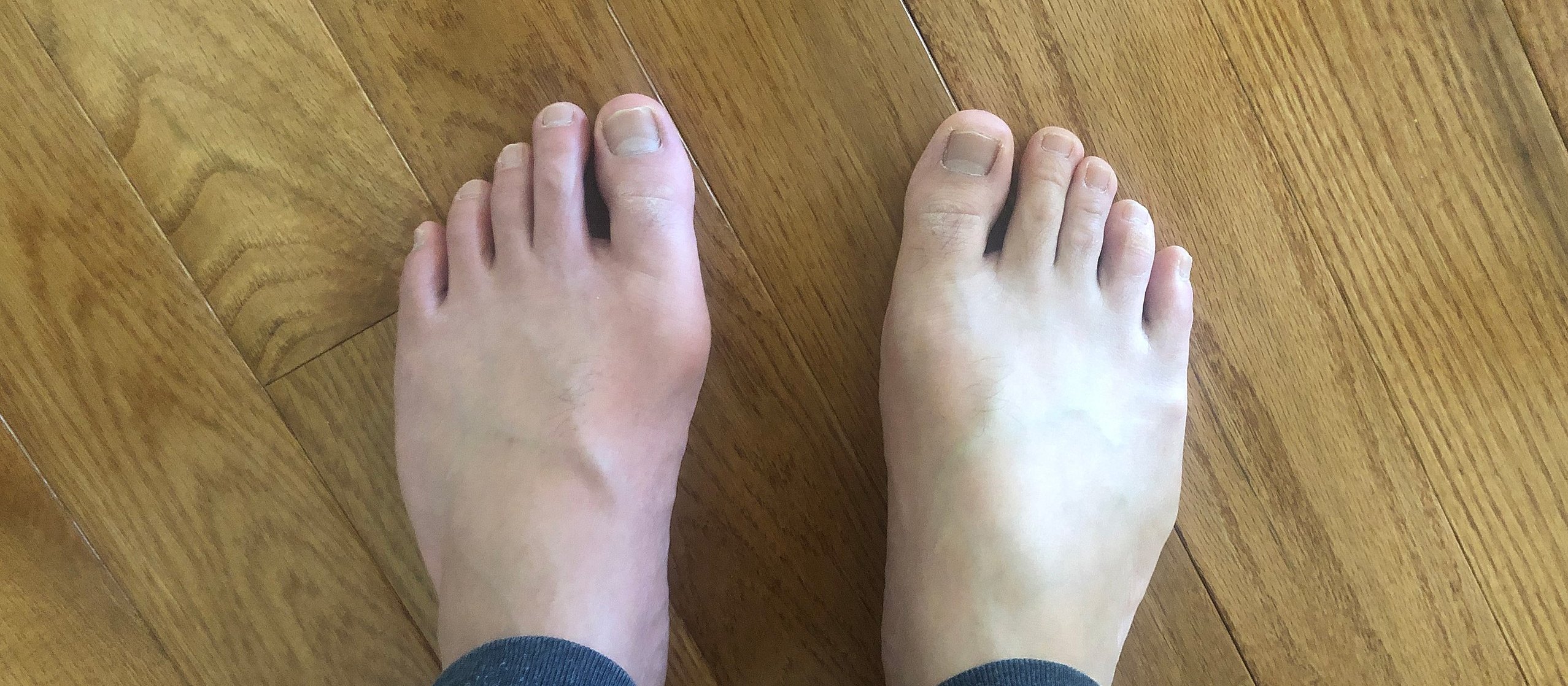 Gout