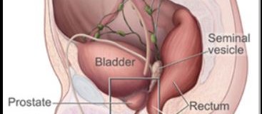 Bladder diagram