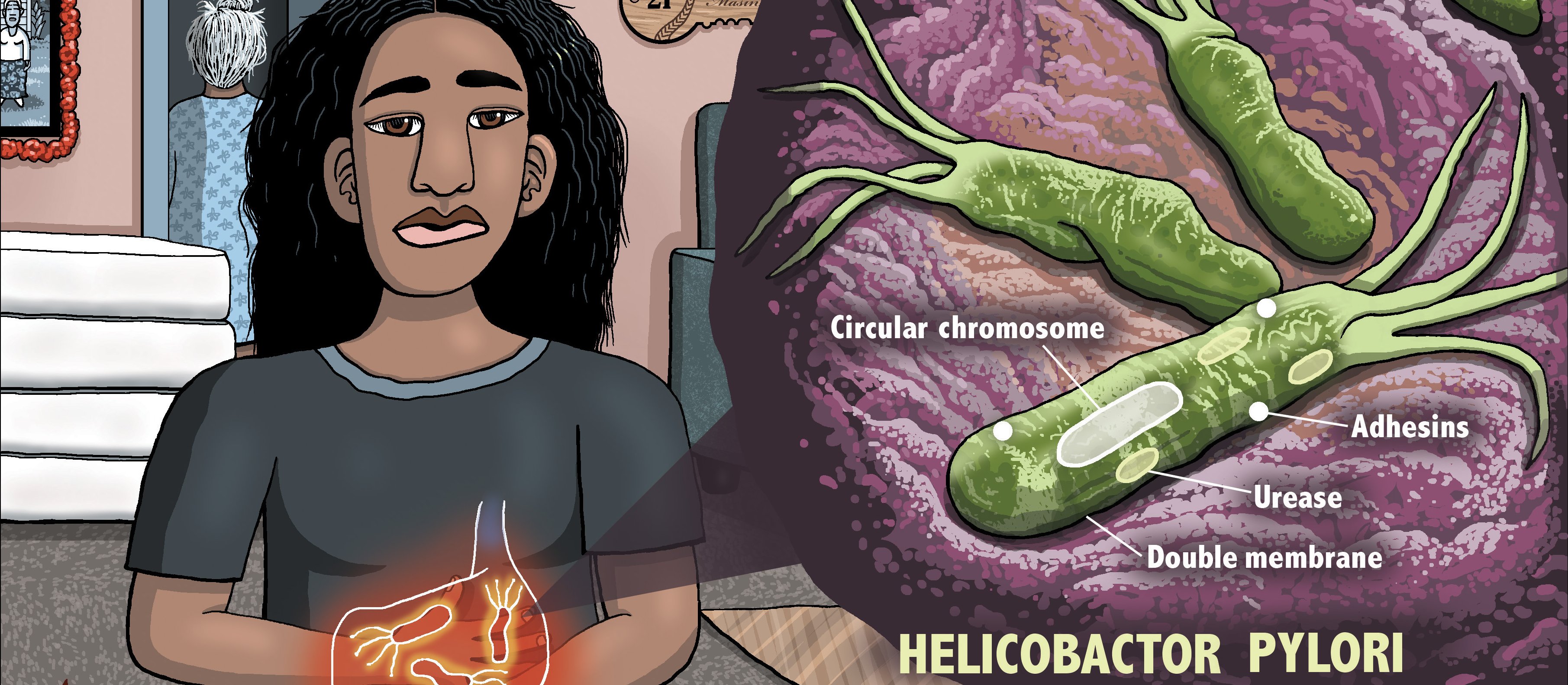 Helicobacter pylori
