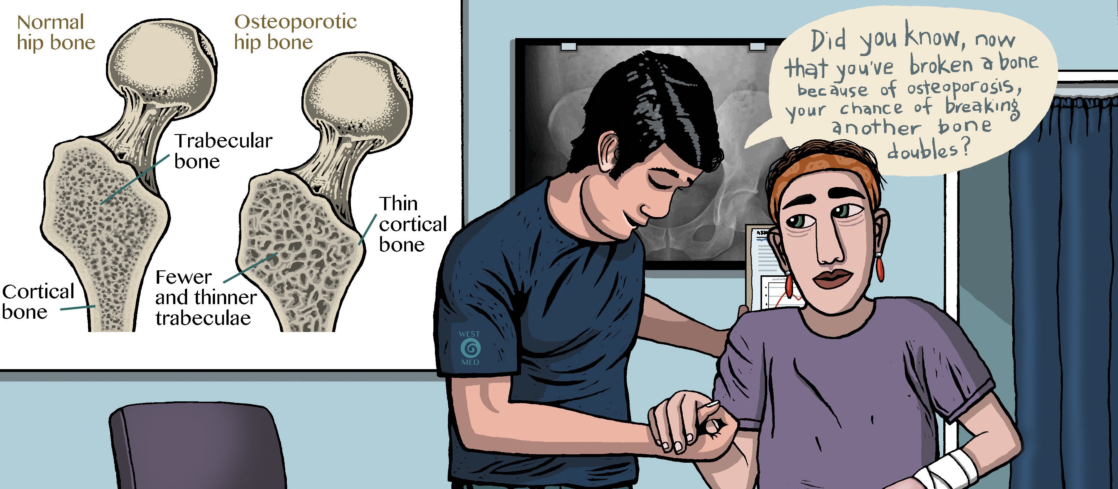 Osteoporosis