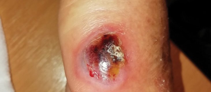 Dermatology_Figure-2.