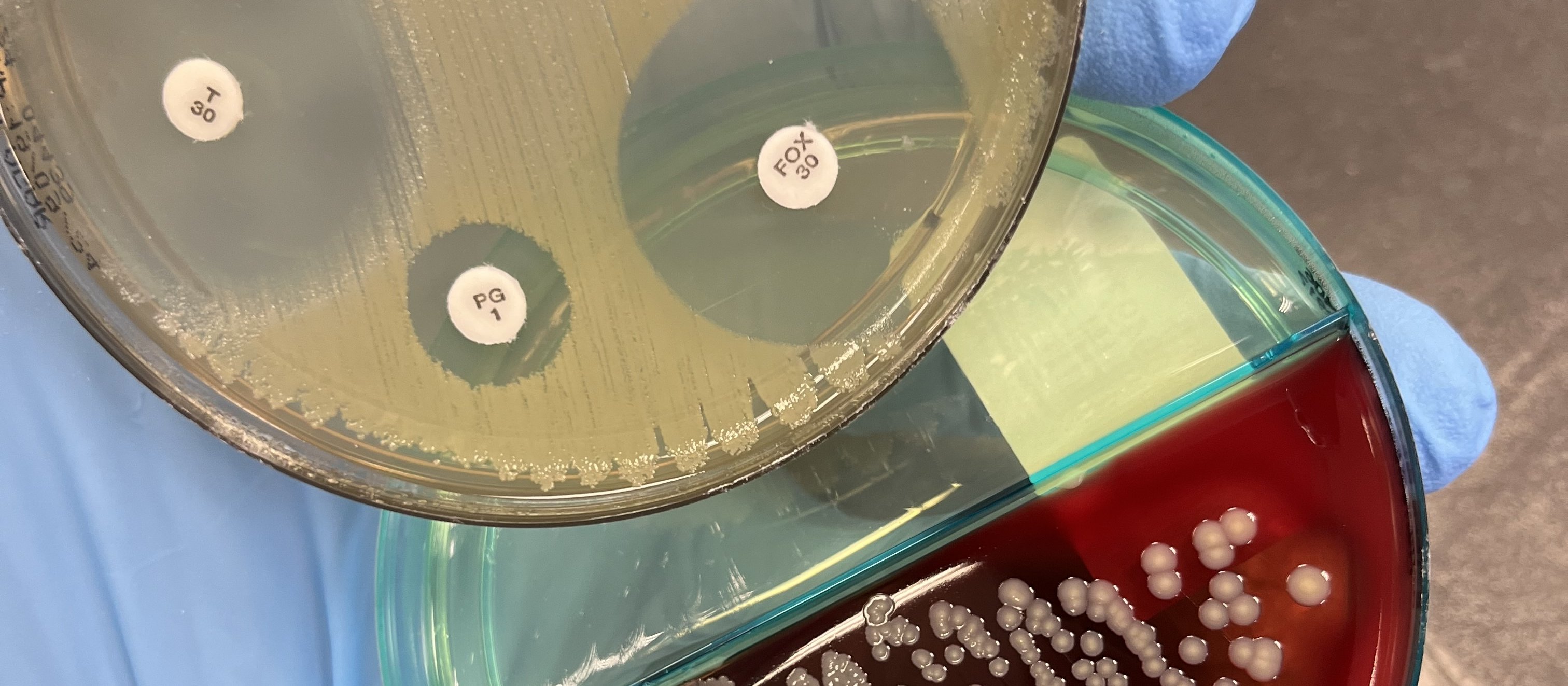 Agar plates