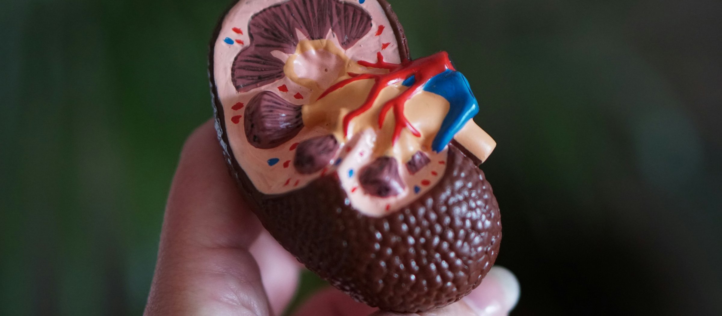 Pharma_Kidney