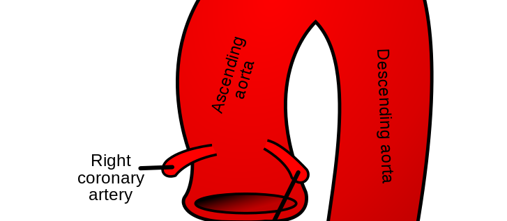Aorta