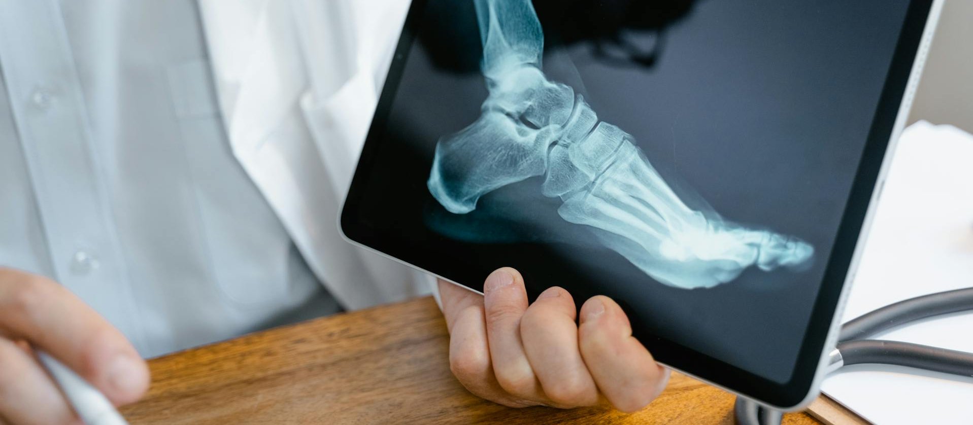 Ankle x-ray