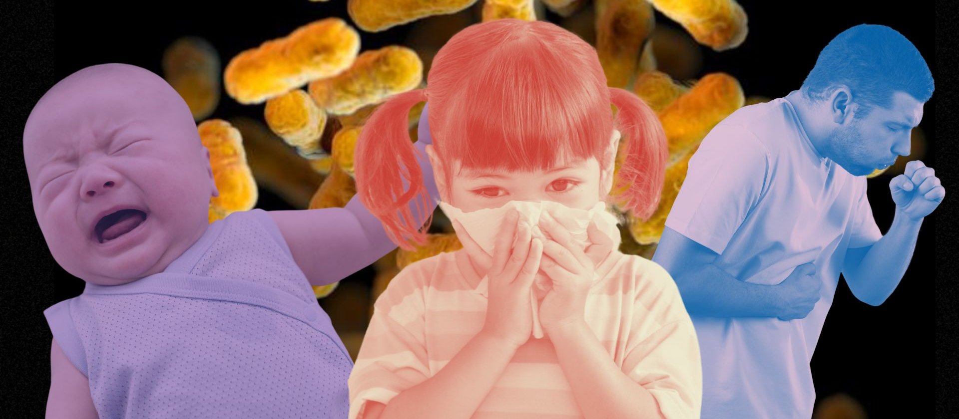 Whooping cough, pertussis