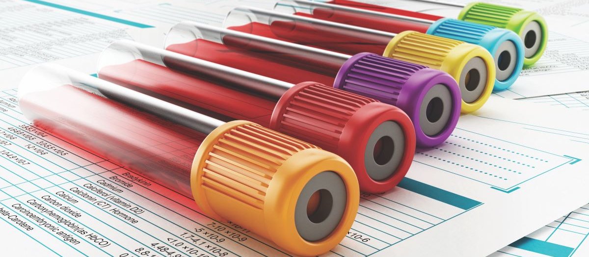 Blood samples
