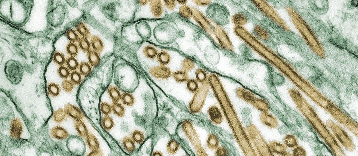 Flu, H5N1