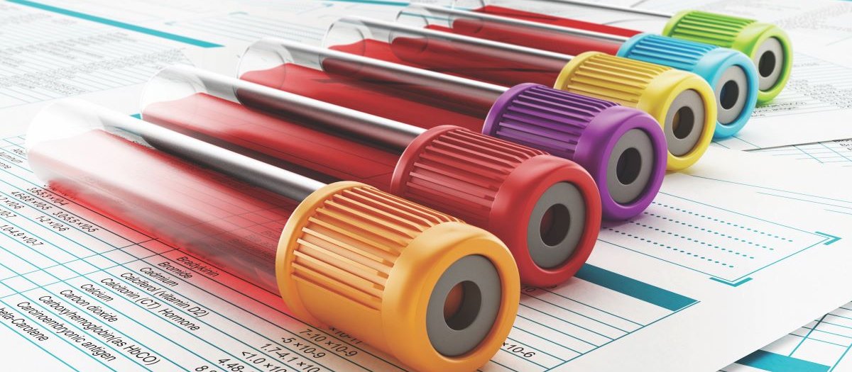 Blood test samples