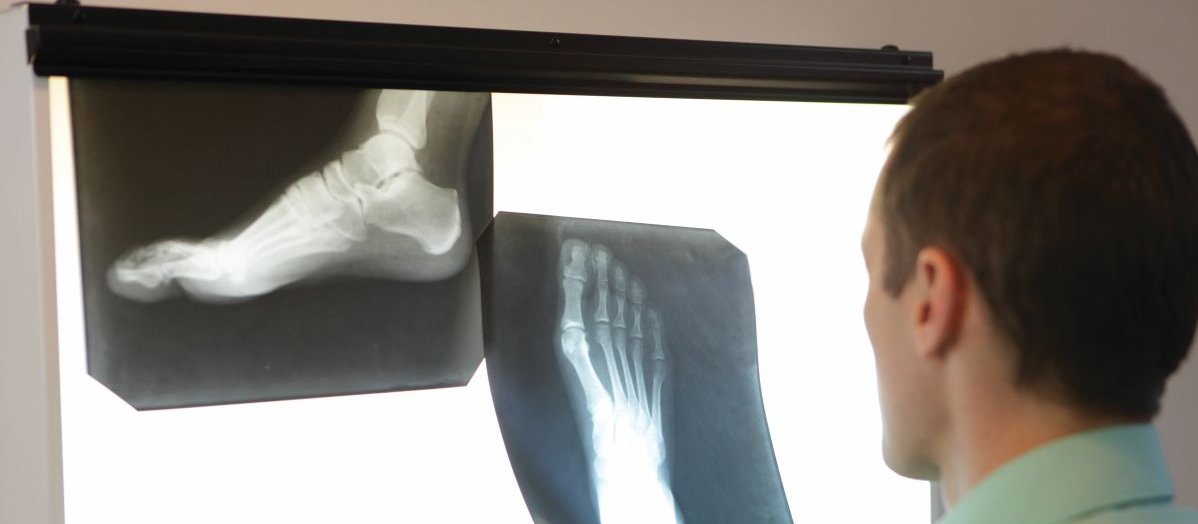 x-ray, ankle, foot, radiologist