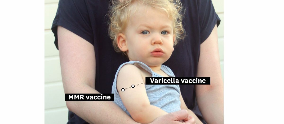 Injection placement