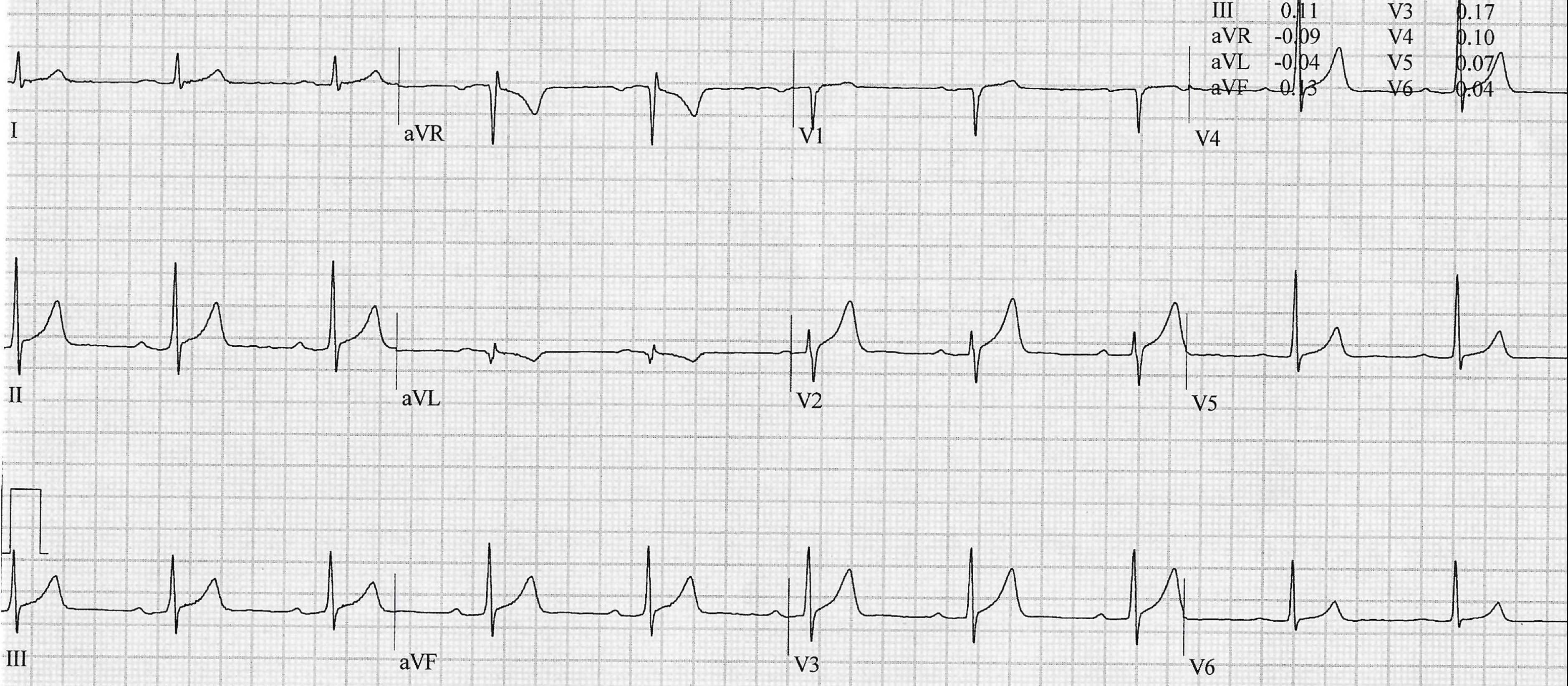 ECG May 2025