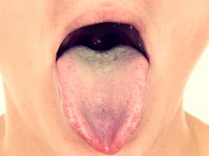 open mouth