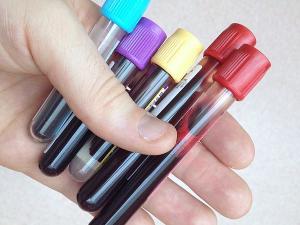 blood samples for testing