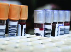 test tubes