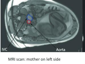 MRI image