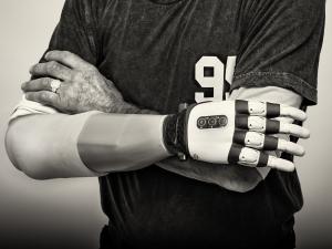 Artificial limb