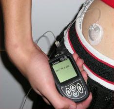 Insulin pump 2