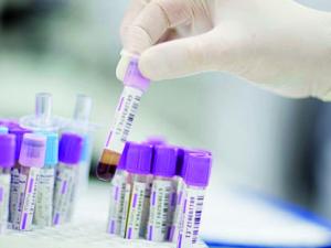 Prostate cancer test