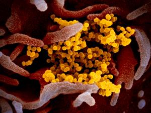 Novel Coronavirus SARS-CoV-2 