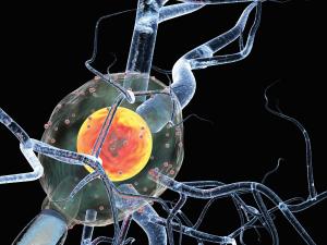 multiple sclerosis