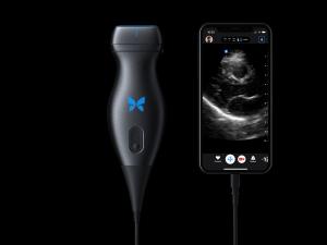 Butterfly IQ portable ultrasound