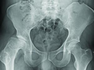 Sports Medicine figure, Hip and groin
