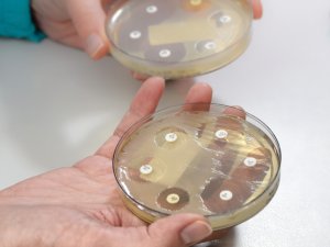 A zone of no growth around an antibiotic-impregnated disc demonstrates a susceptible organism 