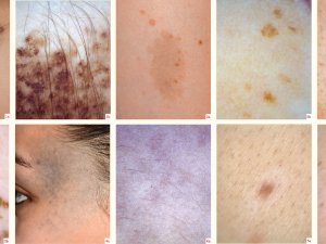 Dermatology Sept