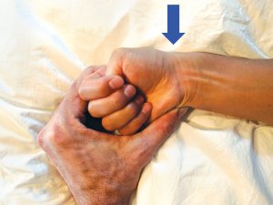 Wrist injury Sports Medicine Figure 1