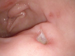 Gastroenterology