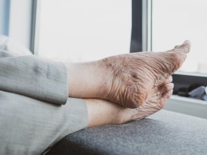 Old feet