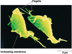 Trichomonas vaginalis