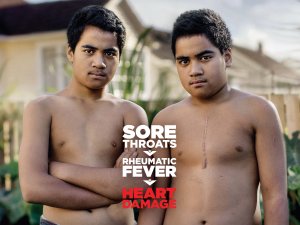 Twins poster rheumatic fever