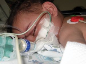 Unwell unvaccinated child