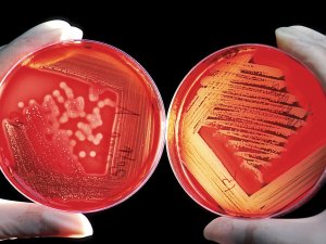 From The Lab Culture Plate CR Wiki Images Pixabay