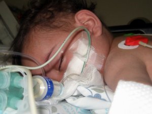 Pneumococcal disease