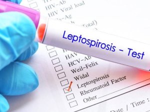 The Auckland Regional Public Health Service says there has been an increase in leptospirosis notifications over the past two weeks which may be linked to the recent weather events [Image: LDR]