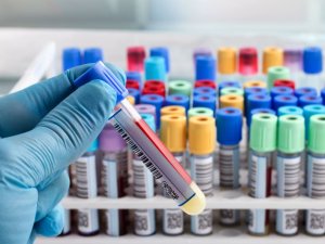 Lab worker 123RF
