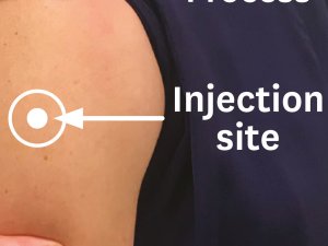 Vaccines Injection Site