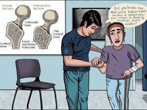Osteoporosis
