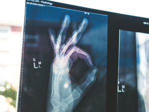 X-Ray