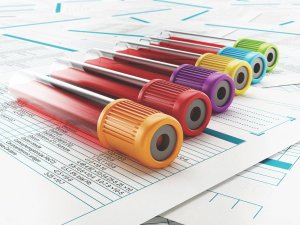 Blood test samples