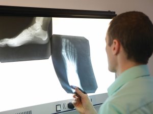 x-ray, ankle, foot, radiologist