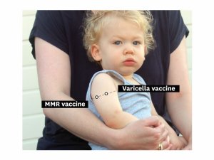 Injection placement