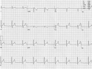 ECG May 2025
